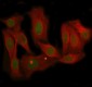 Anti-MBD3 Rabbit Monoclonal Antibody