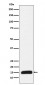 Anti-Histone H3 (mutated K27 Met) Rabbit Monoclonal Antibody