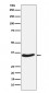 Anti-EXOSC7 Rabbit Monoclonal Antibody
