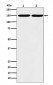 Anti-Collagen III Rabbit Monoclonal Antibody