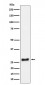 Anti-SNRPA1 Rabbit Monoclonal Antibody