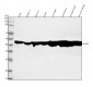 Anti-ACAA2 Rabbit Monoclonal Antibody