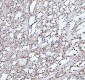 Anti-TAF15 Rabbit Monoclonal Antibody