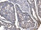 Anti-SOD2 Antibody Picoband™ (monoclonal, 2B12B1)