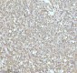 Anti-GCLM Rabbit Monoclonal Antibody