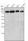 Anti-GFPT1 Rabbit Monoclonal Antibody