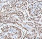 Anti-RBM3 Rabbit Monoclonal Antibody