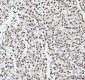 Anti-RBM3 Rabbit Monoclonal Antibody