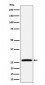 Anti-AK2 Rabbit Monoclonal Antibody