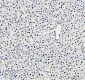 Anti-HNRNPM Rabbit Monoclonal Antibody