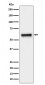 Anti-FPGS Rabbit Monoclonal Antibody