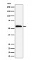 Anti-PNK / PNKP Rabbit Monoclonal Antibody