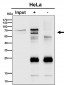 Anti-PPP2R5D Rabbit Monoclonal Antibody