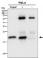 Anti-EMC4 Rabbit Monoclonal Antibody