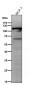 Anti-PI3 Kinase p110 beta Rabbit Monoclonal Antibody