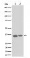Anti-ELOVL5 Rabbit Monoclonal Antibody