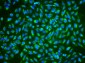 Anti-ALDH2 Antibody Picoband™(monoclonal, 6H2)
