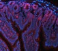 Anti-NKCC1/SLC12A2 Antibody Picoband™ (monoclonal, 6G7D2)