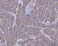 Anti-MDH2 Antibody Picoband™ (monoclonal, 5D8C1)