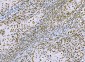 Anti-CTBP2 Antibody Picoband™ (monoclonal, 7F3E1)
