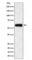 Anti-CD116 Rabbit Monoclonal Antibody