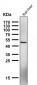 Anti-NFE2 Rabbit Monoclonal Antibody