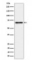 Anti-NR2C2 / TR4 Rabbit Monoclonal Antibody
