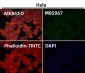 Anti-RAB22A Rabbit Monoclonal Antibody