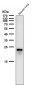 Anti-RAB22A Rabbit Monoclonal Antibody