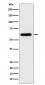 Anti-HRPT2 / CDC73 Rabbit Monoclonal Antibody