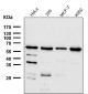 Anti-HRPT2 / CDC73 Rabbit Monoclonal Antibody