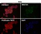 Anti-CABP Rabbit Monoclonal Antibody
