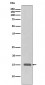 Anti-Histone H3 (tri methyl K27) Rabbit Monoclonal Antibody