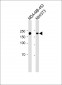 HER2 Antibody
