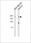 HER2 Antibody