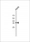 FGL1 antibody