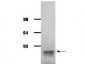 Anti-ALDOLASE [Rabbit Muscle] (GOAT) Antibody