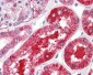 Anti-FERRITIN (Human Spleen) (RABBIT) Antibody