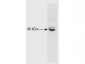 Anti-RFX5 (N-terminal) (RABBIT) Antibody