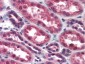 Anti-IKKα (RABBIT) Antibody