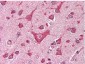 Anti-CaM Kinase IV (RABBIT) Antibody
