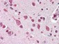 Anti-Cul7 (C-terminal specific) (RABBIT) Antibody