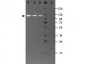 Anti-BETA GALACTOSIDASE (E.coli) (RABBIT) Antibody