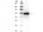Anti-CHOLINE OXIDASE (Alcaligenes species) (GOAT) Antibody Biotin Conjugated