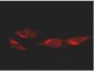 Anti-p53 (MOUSE) Monoclonal Antibody