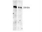 Anti-Thyroglobulin (MOUSE) Monoclonal Antibody