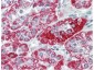 Anti-TRPC6 (MOUSE) Monoclonal Antibody