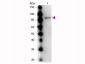 Anti-UREASE (Jack Bean) (RABBIT) Antibody