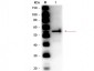 Anti-ALDEHYDE DEHYDROGENASE (Yeast) (RABBIT) Antibody Peroxidase Conjugated