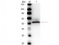 Anti-HEXOKINASE (RABBIT) Antibody Peroxidase Conjugated